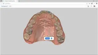 Medit App Checkpoint: Control de Calidad para Pr&oacute;tesis Dentales