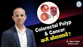 Colorectal Polyp & Colorectal Cancer कसे ओळखावे?