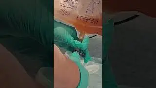 How to Empty Foley Catheter Bag