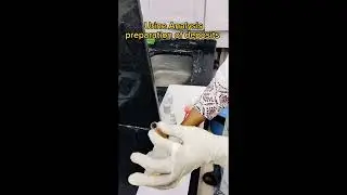 சிறுநீர் பரிசோதனை #urine analysis #urine#test#lab#blood#urineroutine#kirumi#urine sugar#sugar# uppu