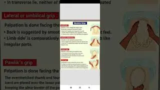 obstetrics grips #gynaecology