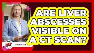 Are Liver Abscesses Visible on a CT Scan?
