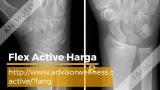 Flex Active supplement for joint pain | Flex Active Harga