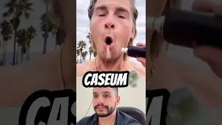 Caseum 😱‼️‼️‼️