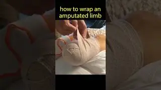 Как перевязать культю #ампутация #ампутант