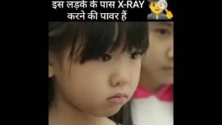 Is ladke ke pas x-ray ki power hai | movie scene | explained in hindi #shorts #ytshorts