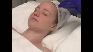How to be a Redhead Review: KUR Skin Lab's PCA Skin Chemical Peel