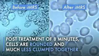 iMRS 2000 - Live Blood Microscopy Analysis