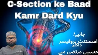 Back Pain After C-Section | Low Back Pain Causes & Physiotherapy Tips