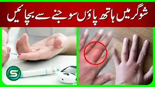 How to Prevent Swelling in Hands and Feet in Diabetes | Dr. Samina Ashfaq | Diabetes Specialist