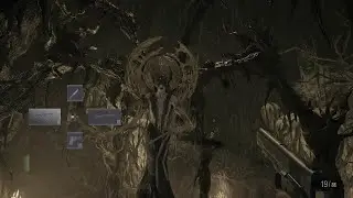 How do you defeat Miranda? Resident Evil Village RE8 👍 (easy peasy)