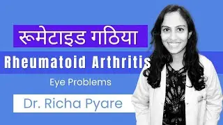 Rheumatoid Arthritis & eye problems?  Dr. Richa Pyare @shroffeyecentre.official