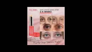 Retinol Eye Stick, Retinol Eye Cream#amazonproducts#beauty#viralvideo#fyp#freepalestine