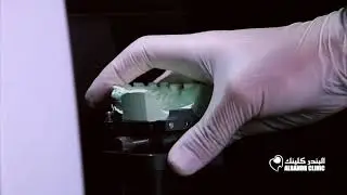 جهاز تصميم وصناعة الاسنان بواسطة الكمبيوتر - CERAMILL CAD/ CAM SYSTEM