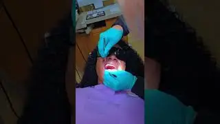 Come with me to my dental appointment for a clean up. 😎😅😋 #dentalpain #teeths #toothloss