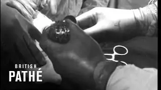 Modern Surgery In Russia.  (1968)