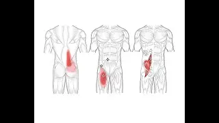 Psoas Muscle Pain? Why Your Hip Flexor Feels Tight After Running