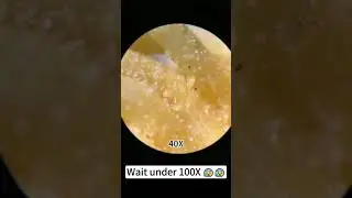The Hidden World of Instant Noodles: A Microscopic View #noodles #explore #instantrecipe #noodle