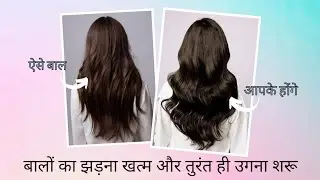 Doctor's Recommended Serum and Shampoo for Hair Regrowth and HairFall Control | My Honest Review |