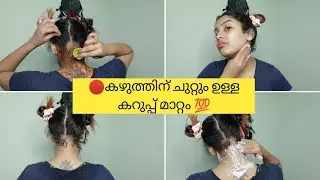 Remove Darkness ,Pigmentation Around Neck 💊Best Treatment For dark neck 📍Glamyganga Skincare