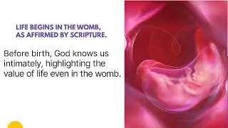 What does the Bible say about abortion