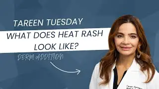 Горячая, зудящая и шершавая кожа? Возможно, это потница. ☀️