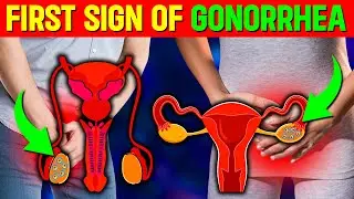 First Warning Signs of Gonorrhea: Spot the Danger Early!
