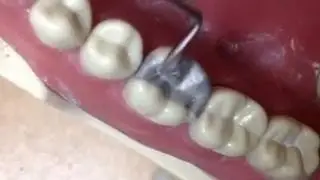 Operative demo for adc exam