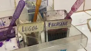 Prélèvement vaginal