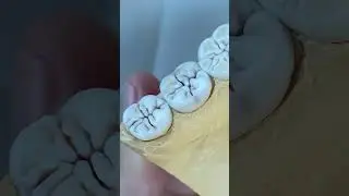 wax up