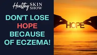 Why HOPE Is So Important | Camille Knowles