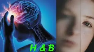 Headache and blurred vision causes