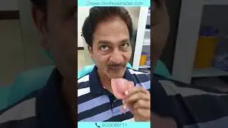 Complete Denture | full teeth replacement