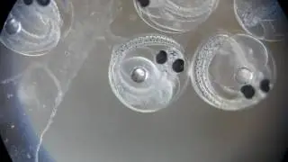 アシロ科ソコボウズの卵