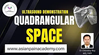 Quadrangular Space Under Ultrasound | Axillary Nerve Identification Live by Dr. Chinmoy Roy