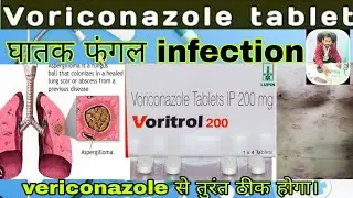 Voriconazle 200 mg | Vorivonazole 200 mg tablet uses in hindi