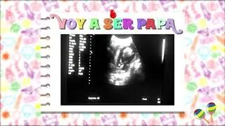Will Ateus - Voy a ser Pap&aacute;👶 [Audio Oficial]