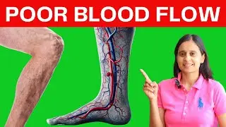 8 Alarming Signs of Poor Blood Circulation | Hitanshi