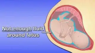 Fetal Development Week 31 (Pregnancy Health Guru)