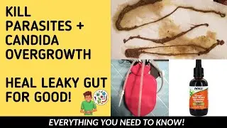 How to Get Rid of PARASITES  + Candida Overgrowth | Natural Gut Cleanse