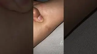PENGALAMAN DAN CARA MENGHILANGKAN KUTU KUCING / PINJAL / KUTU LONCAT DI DALAM RUMAH