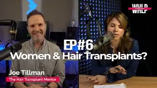 Joe Tillman - Women and Hair Transplants | Women&rsquo;s Hair Loss Project Ep #6