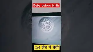 ivf lab 🔬 | microscope | Types of microscope | microscopy | लैब वर्क | Different microscope | ivf in