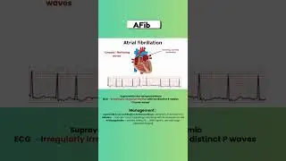 Atrial Fibrillation  #nclex #nursing