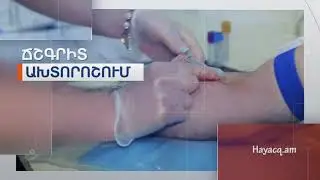 Հայացք․АМ-Elit-Med Medical Center/Էլիտ-Մեդ բժշկական կենտրոն