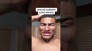 JAWLINE SURGERY GONE *EXTREMELY* WRONG #shorts #minecraft #memes