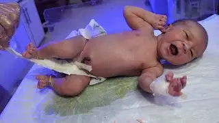 So Cute! Newborn Baby Passing Urine on Warmer 😃💧#baby #newborncare #baby #neonatologist #newborn