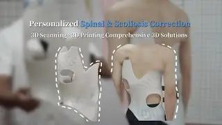 🎥 3DeVOK MQ 3D Scanning & TPM3D SLS 3D Printing | A Customized Revolution in Scoliosis Bracing