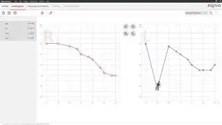 Enter an audiogram in Connexx 9 | Signia Hearing Aids