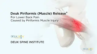 How to CURE Piriformis Muscle Syndrome with the Deuk Piriformis Release - (3D Animation)